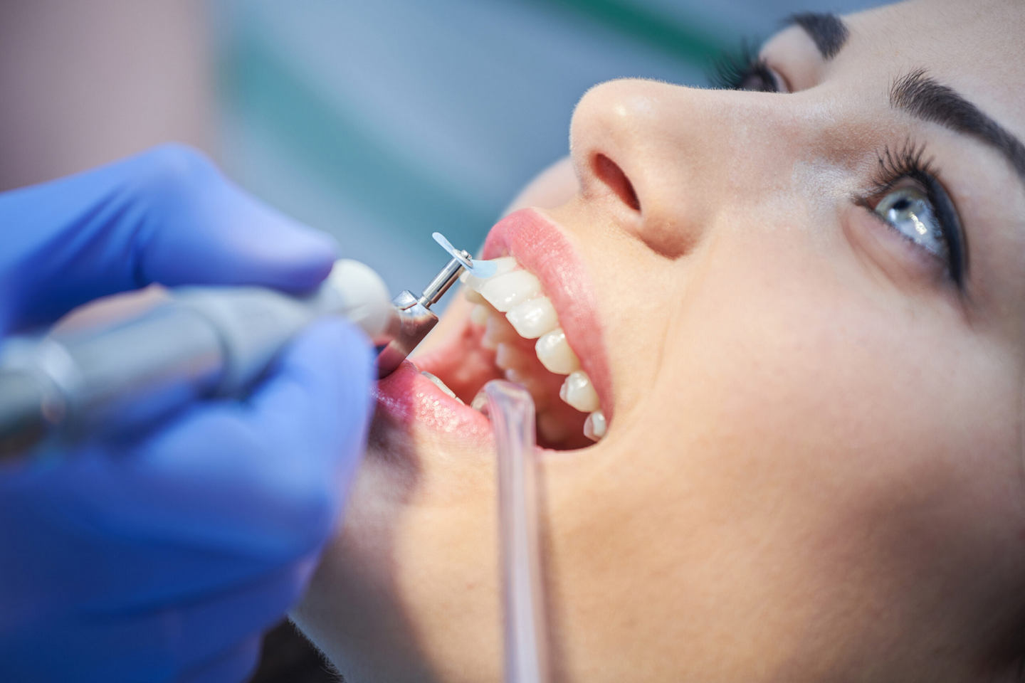 Do’s and Don’ts After Getting a Tooth Extraction